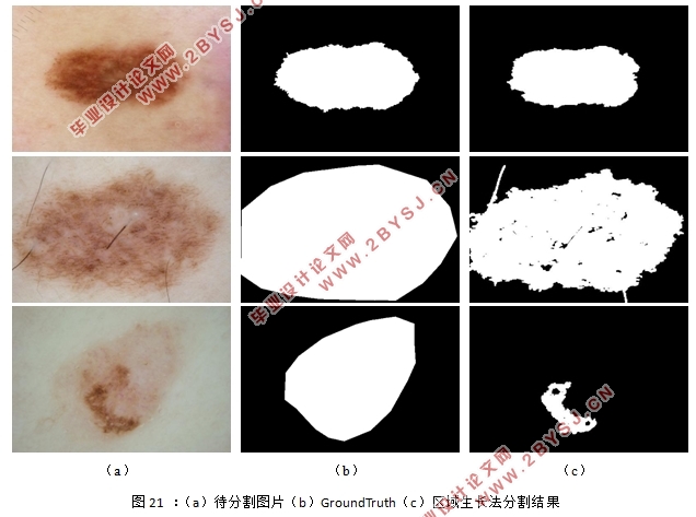 基于SegNet网络的皮肤癌病变区域的自动分割