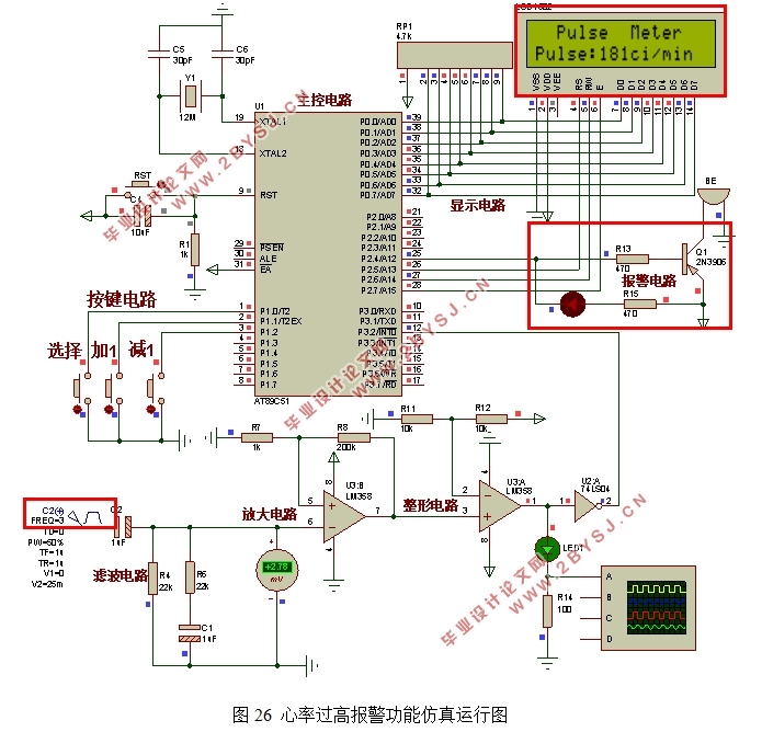 基于51单片机脉搏测量仪的设计(附Proteus仿真,电路图,代码)
